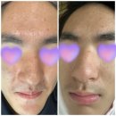 아쿠아스킨케어 이미지