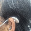 유니트론보청기 영대병원센터 | 전주벨톤보청기, 🌾 70대 여성 유니트론 목시 착용 후기