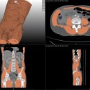 엠에스병원 이미지