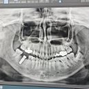 로뎀치과의원 이미지