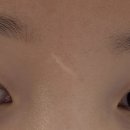 잠실눈썹 에이민 속눈썹펌