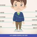 급성 림프구성 VS 골수성 백혈병 소아백혈병 증상 이미지