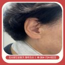 굿모닝보청기제주지사 | 제주 노형동 보청기, 리사운드 옴니아 오픈형 후기