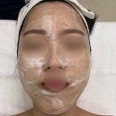 청담美스킨케어 | 전주 에코시티 피부관리 끝판왕! 스킨플라청담 100샷 모공케어 솔직 후기 (ft. 나비존 모공 지우개...