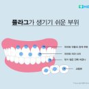 치아 건강 지키는 올바른 양치질법 이미지