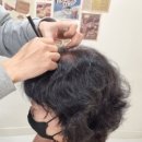 두피움 이미지