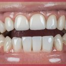 미소 소프트웨어 이미지