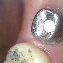 성원치과기공소 이미지