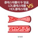 콜레스테롤의 두 얼굴, LDL콜레스테롤 VS HDL콜레스테롤 ﻿ 이미지