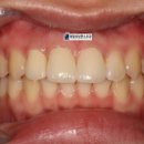 청담치과기공소 이미지