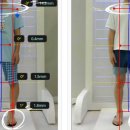 김포아이제일병원 | [김포아이제일병원 성장치료센터] 9살(만 8세) 여아 자세교정 치료 후기 !!