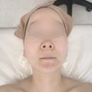 은빛에스테틱 | 영종도 웨딩관리, 승모근관리 전문 은빛에스테틱에서 3V테라피 &amp; 윤곽관리 체험 후기