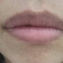 아우름의원 이미지