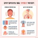 피부과 치료를 받고 있는데도 얼굴이 계속 빨갛다면? - 안면홍조 근본적인 치료법에 대해 이미지