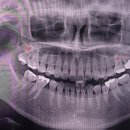 미.서울치과 | 용인 수지 치과 후기