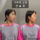 자세교정 스트레칭 | 거북목 자세 교정 스트레칭 배우기 청라 밸런스테라피에서