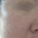 중계의원 리터치 후기/생각보다 할 게 없다?/대만족/고민말고 예약부터 ㄱㄱ