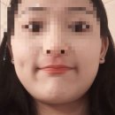 한불스킨케어 | 아토피 현실적인 관리 팁(Feat. 성인 아토피 극복과정)