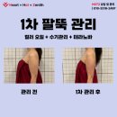 비타노바 | 포항바디관리, 눈으로 확인되는 변화!팔뚝 라인, 2차 테라노바 관리 리얼 변화 공개✨