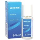 에스디피부과의원 | 무릎 사마귀 없애는 법, 사마귀 제거 비용 및 후기