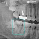 형치과의원 이미지