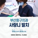 부산중구치과 사랑니 발치 환자들의 후기를 확인해보세요!
