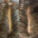 구로-구로-구로-2899 | 구로 두피 관리 &#39;브로우기프트 구로점&#39; 체계적인 두피 관리 후기!