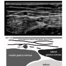 Skeletal muscle ultrasound. 근골격계 초음파보는 법 이미지