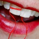 치아교정, 치아교정에 대한 진실과 오해 이미지