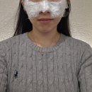 분당우태하피부과의원 | 분당 보톡스 후기｜주름보톡스 4부위 + 스킨보톡스 통증 솔직 정리