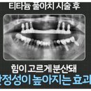 아치치과기공소 이미지