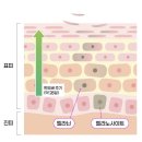 기쁨약국 | 약국 태극제약 도미나크림 사용 후 변화