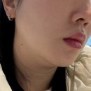 비비한의원 | 부산 서면 한의원에서 튠페이스로 이중턱 뿌시기 2회차 후기