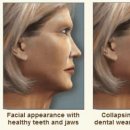 휴플란트치과의원 이미지