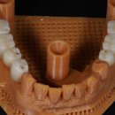 하늘치과기공소 이미지