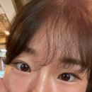 민준약국 | 안검내반성형외과 실비 수술비, 진단비 다받은 후기