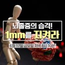 뇌졸중의 습격! 1mm를 지켜라! 이미지