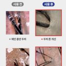 디에스투