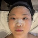 장안로52번길 | 분당 피부, 모공 관리 ‘고원장의 모공세척 테라피 분당점’에서 모공케어 받고 왔어요!