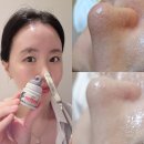 악센다 루티너 멀티밤 후기, 블랙헤드 사용법 효과 부작용 정리