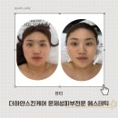 샘물하얀집 | 익산 피부관리 홍조 여드름 민감성 피부 진정후기 더하얀스킨케어