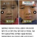 쌍꺼풀 성형수술 받은 일본 초등학생.jpg 이미지