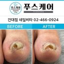 건대 네일 / 네일비타 푸스케어 건대점 / 후기 가격