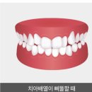 보일치과기공소 이미지