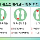 신발뒷굽 바깥쪽 닳으면... 이미지