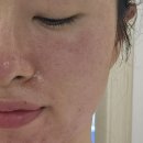뉴서울1차아파트 | 선학동 피부관리 &lt;끌레르뷰티&gt; 미백토닝 한달후기
