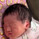 화명일신기독병원 | 부산 신생아 귀교정 후기👂🏻 (화명 일신기독병원) • 비용 • 첫만남 이용권 ok