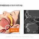 천안수면센타