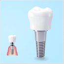 서울온빛치과의원 이미지