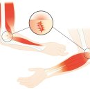 힐링메디칼 이미지